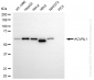 KD-Validated Anti-Activin A Receptor Like Type 1 Rabbit Monoclonal Antibody